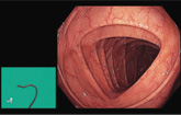 ScopeGuide Image