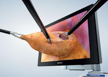 3d Imaging System Olympus America Medical