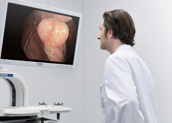 EVIS EXERA III for Gastroenterology