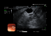 EU-ME3 Ultrasound Processor