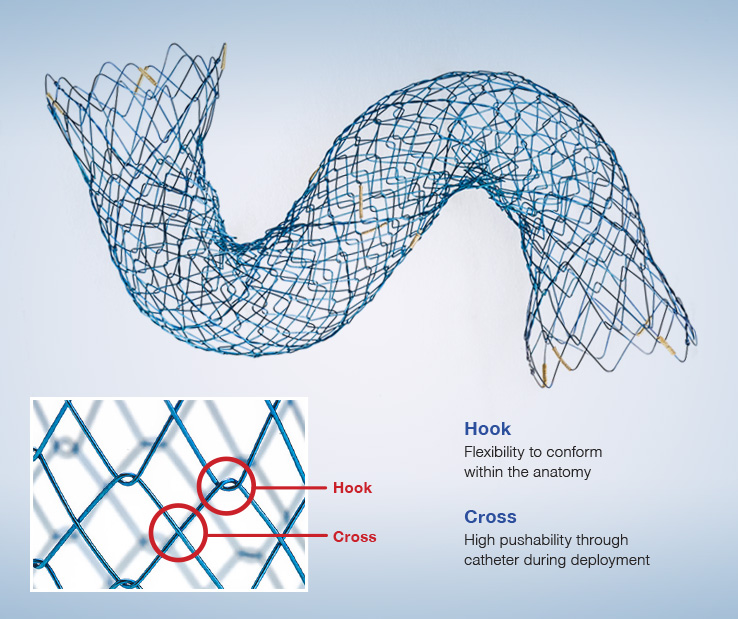 ercp stent