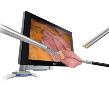 The 3D endoscope: external photography showing the TIPCAMR 1S 3D ORL