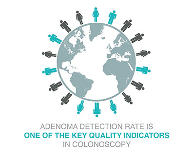 ADENOMA DETECTION RATE IS ONE OF THE KEY QUALITY INDICATORS IN COONOSCOPY