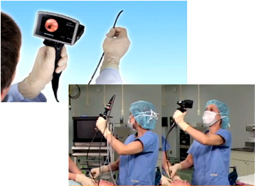 MAF Airway Mobilescopes