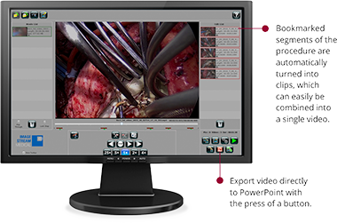 Point of care editing